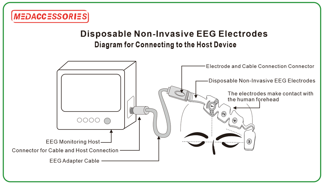 Eeg Sensor for Brain Monitor Disposable Depth of Anesthesia Non-invasive EEG Sensor BIS Sensor EEG Electrodes